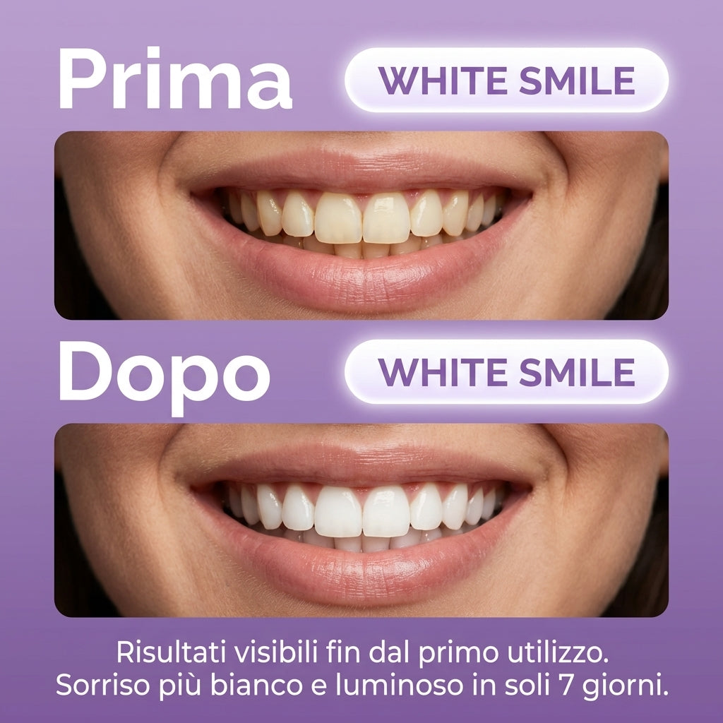 White Smile Strisce Sbiancanti